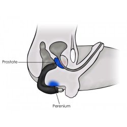 Dobbelt Pleasure Anal og G-Spot Stimulator (vandt�